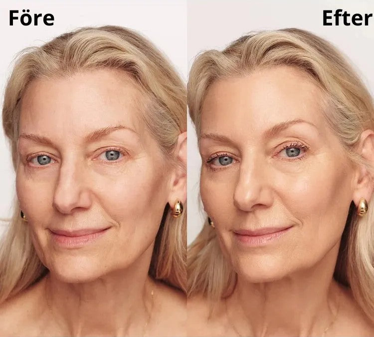 Nymalia 4-i-1 SkinBase