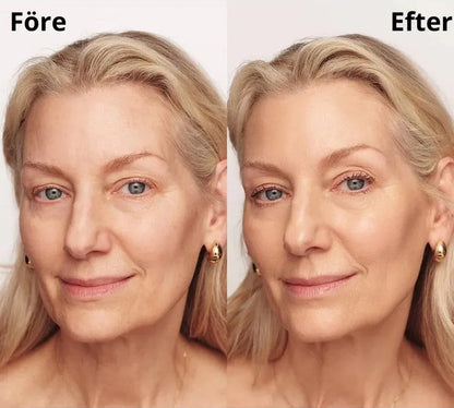 Nymalia 4-i-1 SkinBase