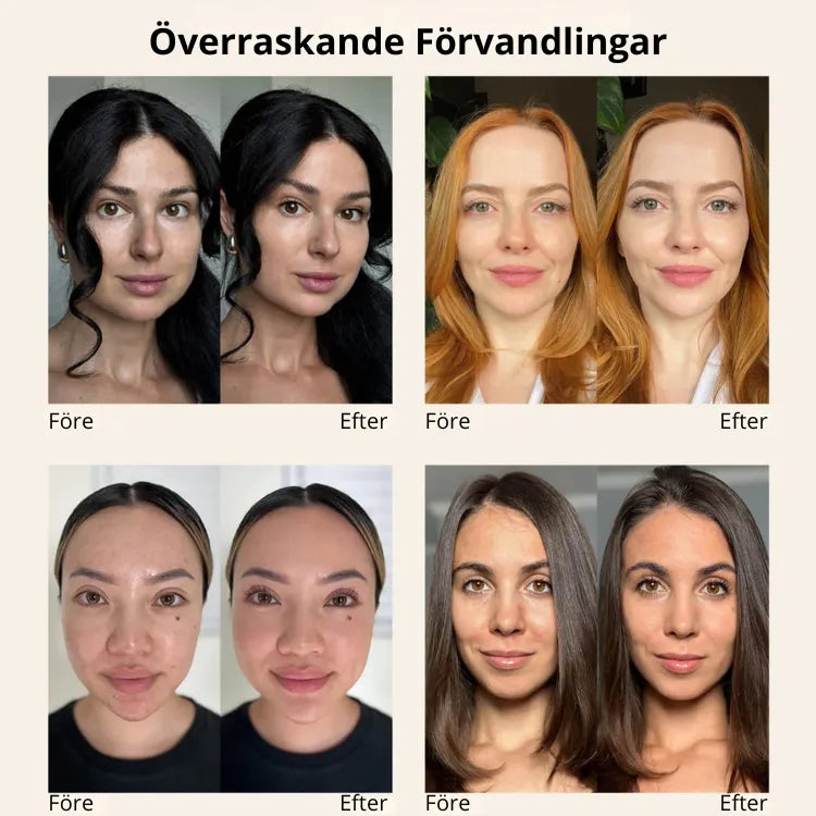 Nymalia 4-i-1 SkinBase