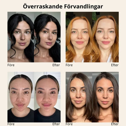 Nymalia 4-i-1 SkinBase